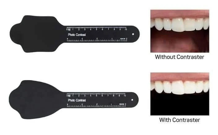 Dental-Photography-Contrast2