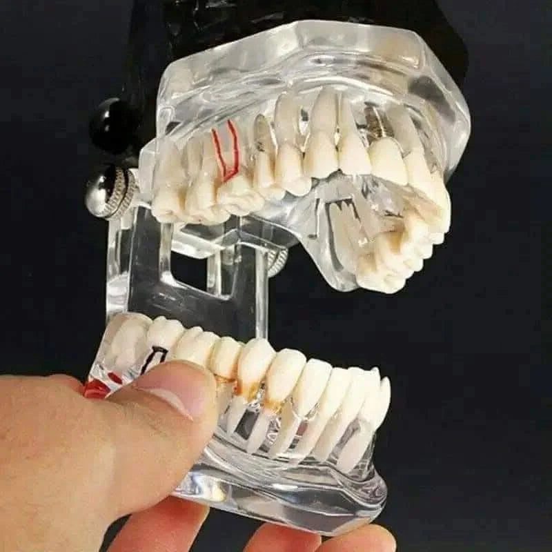 Dental-teaching-model