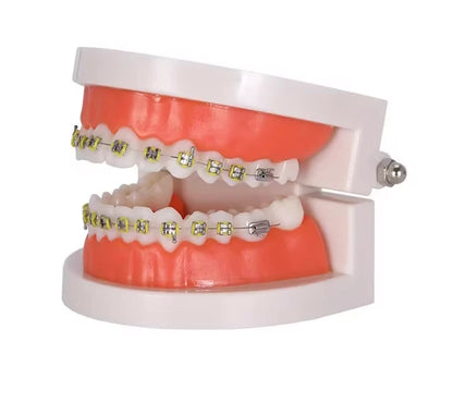 Azdent-Dental-Orthodontic-Teeth-Model-Bracket-Model-e1751986898107