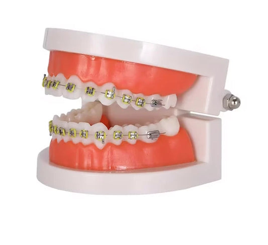 Azdent-Dental-Orthodontic-Teeth-Model-Bracket-Model-e1751986898107