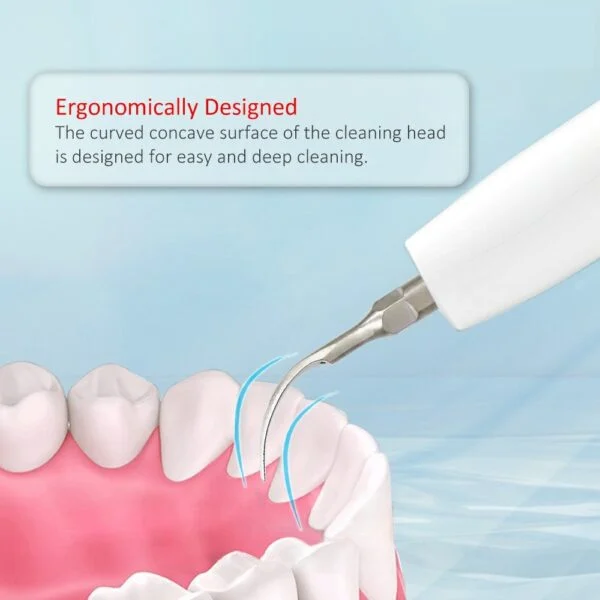 Scaler Tips (5/Pack) - Image 3