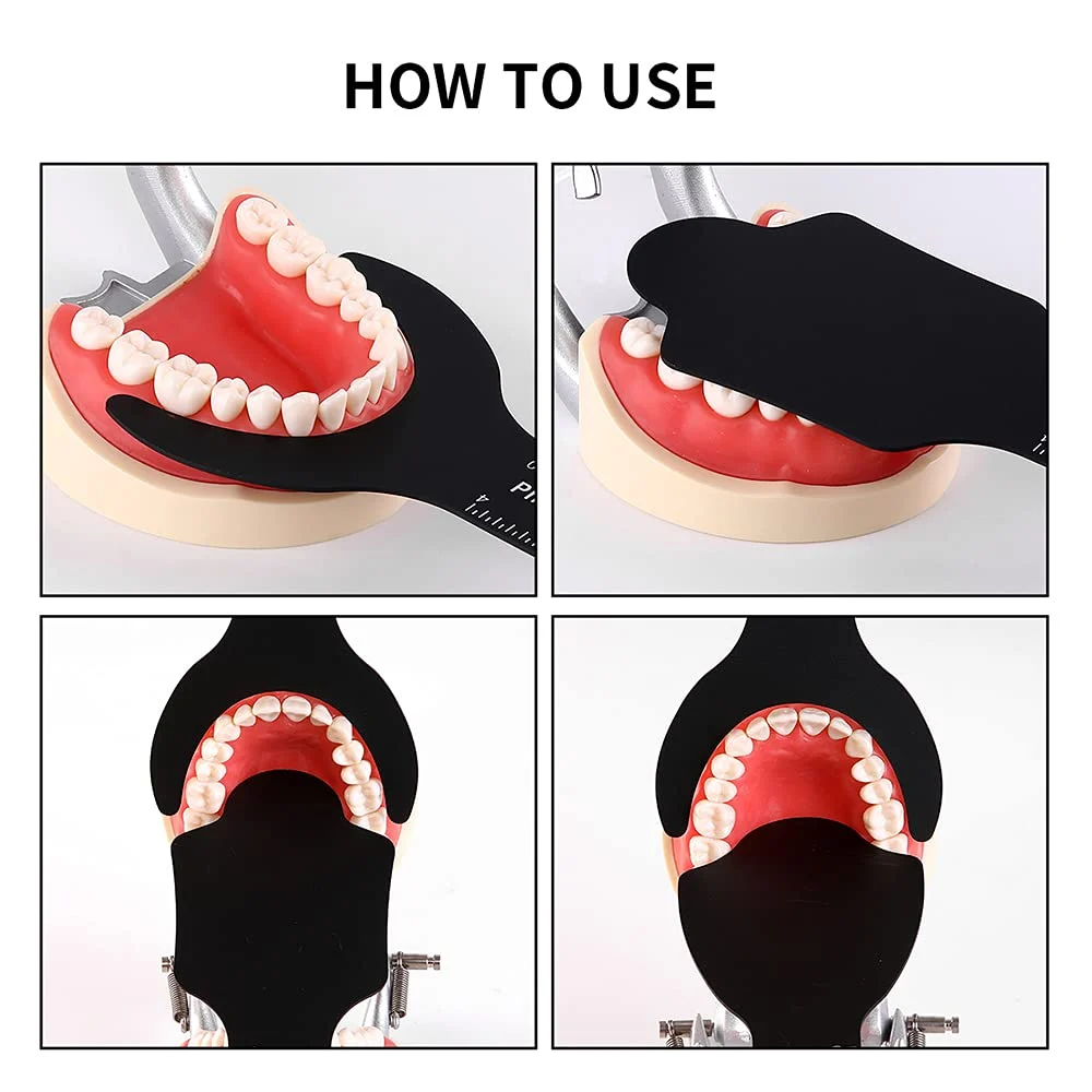 Dental Photography Contrast - Image 3