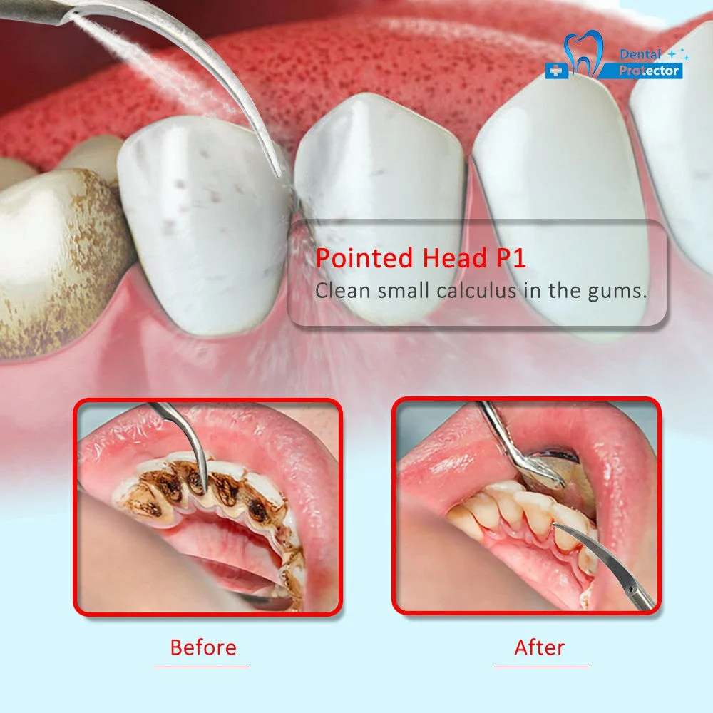 Scaler Tips (5/Pack) - Image 2