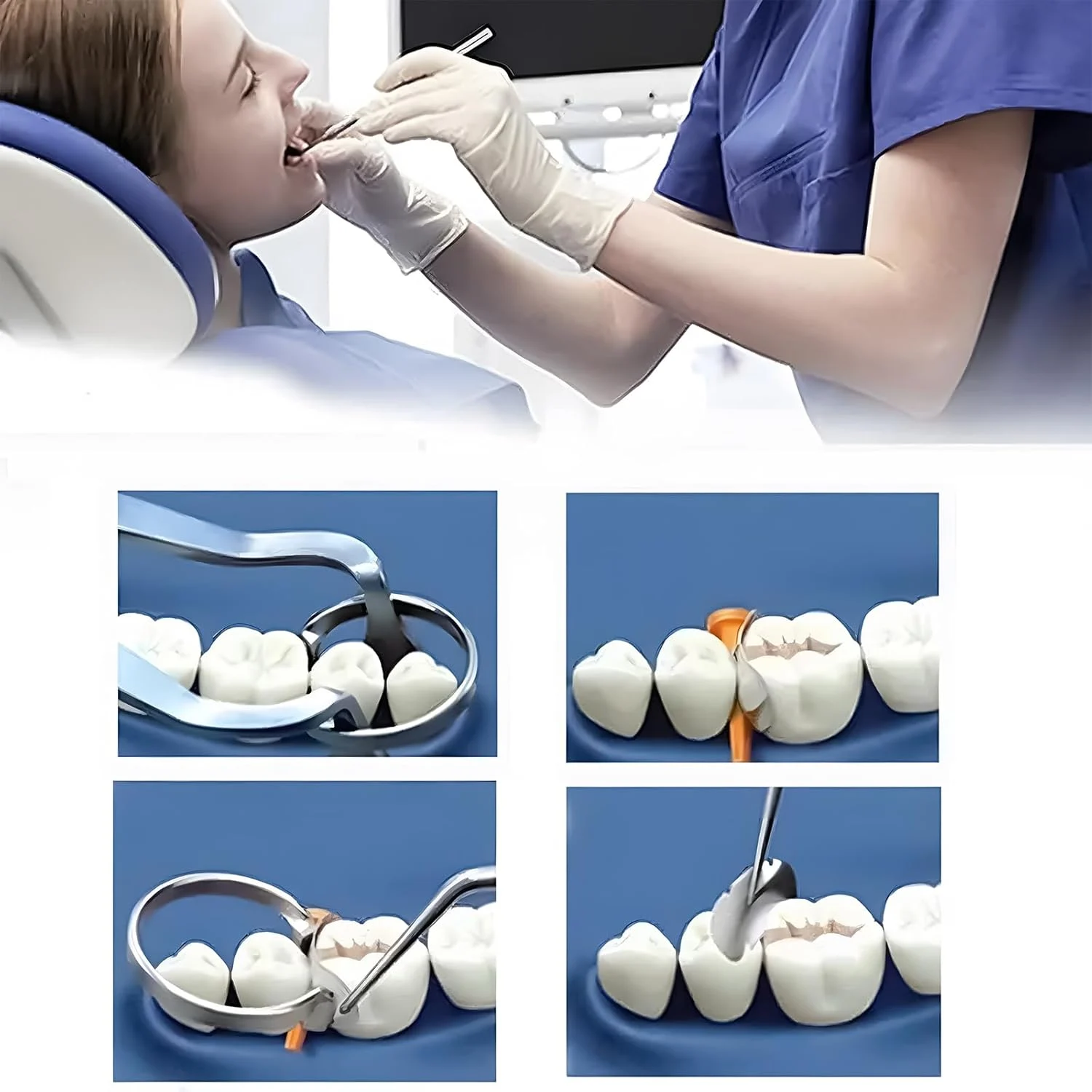 Dental Matrix Bands Sectional Contoured Matrices - Image 4