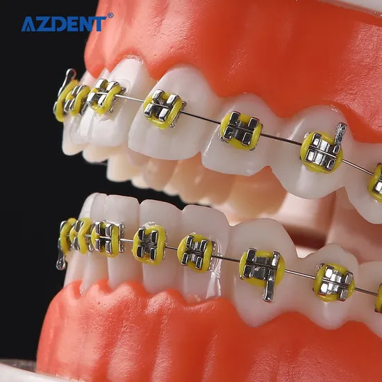 Dental Orthodontic Teeth Model - Image 2