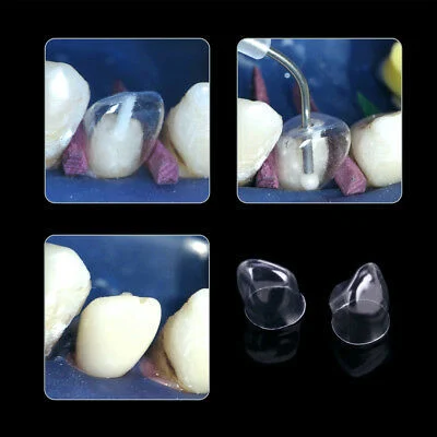 Dental Transparent Crown - Image 3