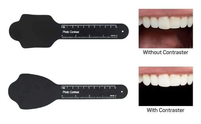 Dental Photography Contrast - Image 4