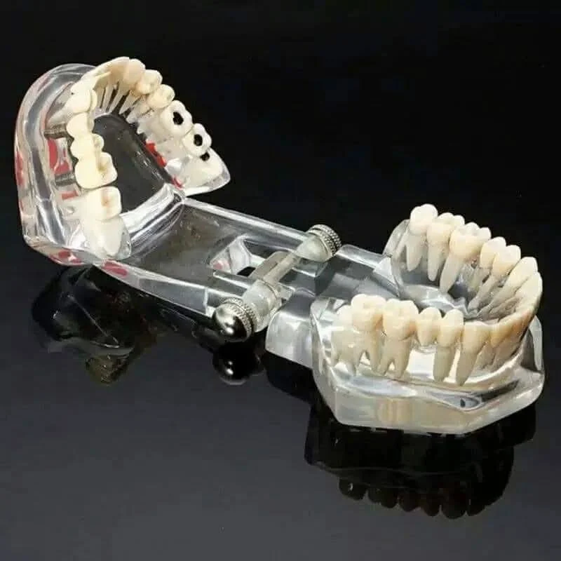 Dental Implant Model - Image 2
