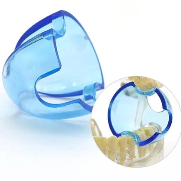 Dental Mouth Opener (5/Pack) - Image 2